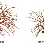 Омоложивающая обрезка крыжовника